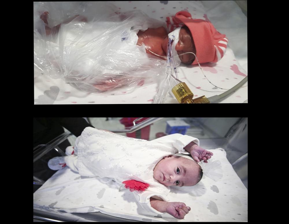 Dünyaya 460 gram gelen bebek 137 günlük mücadeleyle yaşama tutundu