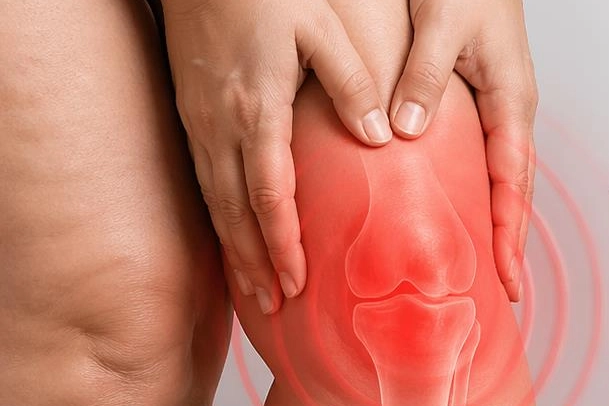 Diz biyomekaniğini bozan s&uuml;re&ccedil;: Lip&ouml;dem