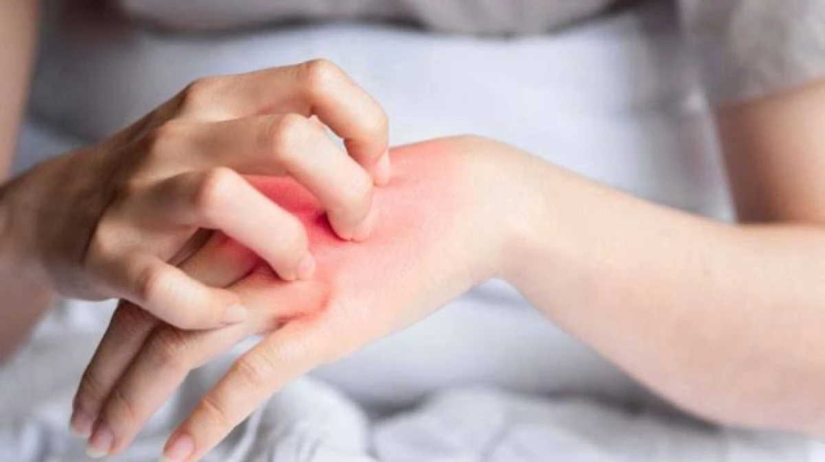 Uzmanından yaz aylarında mantar enfeksiyonuna karşı uyarı
